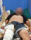 Warga Sambas diduga tersambar petir saat menunggu logistik program Makan Bergizi Gratis (MBG) di steher penyeberangan Dusun Sajad, Desa Tengguli, Kecamatan Sajad. (Foto: Res-Sbs)